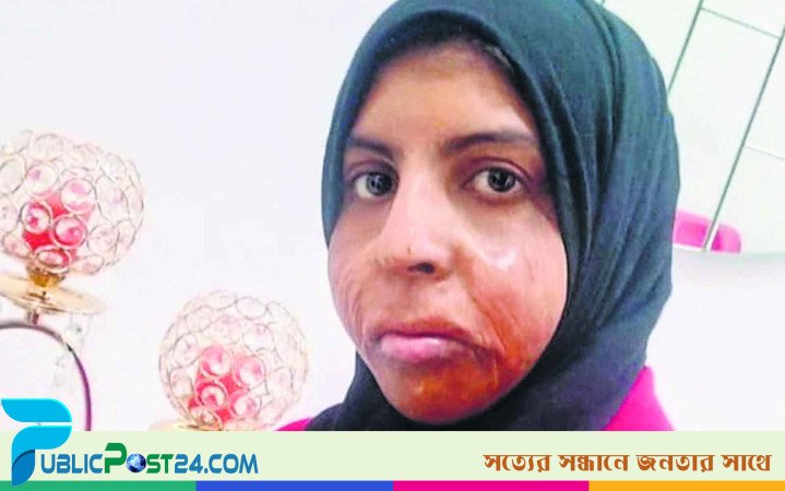 প্লাস্টিক সার্জারি করতে আবুধাবিতে যাওয়া শাহজাদীর ফাঁসি